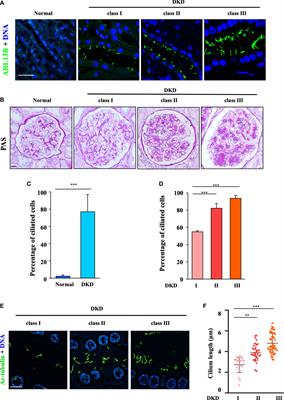 Renal primary cilia lengthen in the progression of diabetic kidney disease